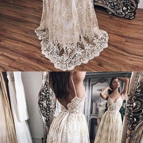 champagne and lace prices